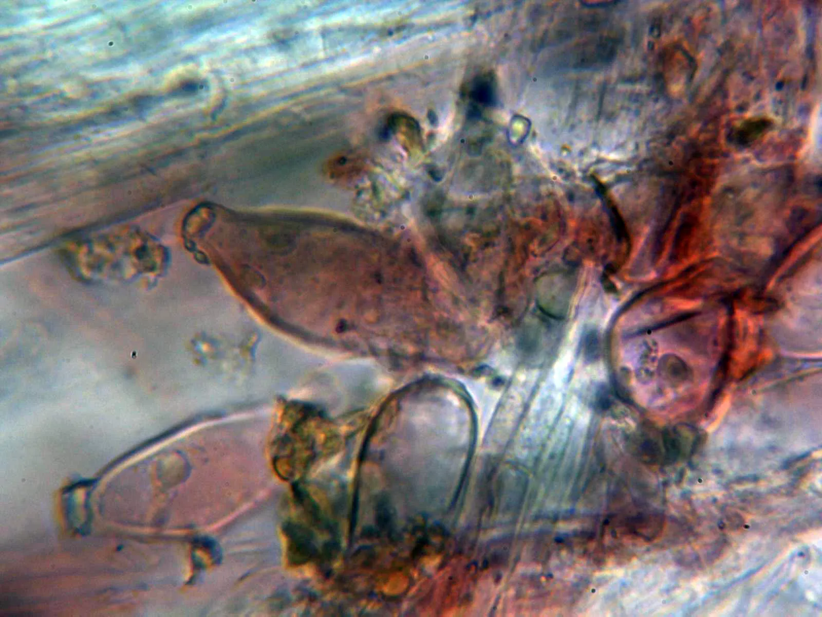 Microscopía de Inocybe mixtilis - 10 - Caulocistidios base